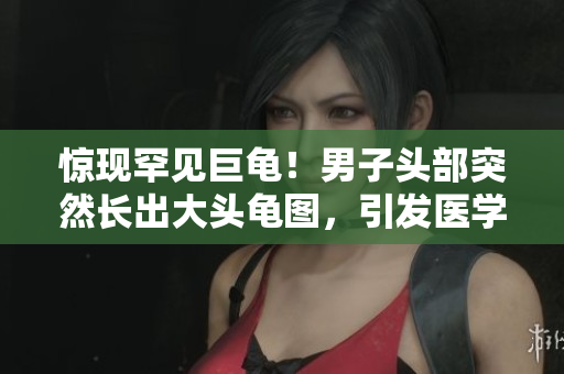 驚現(xiàn)罕見巨龜！男子頭部突然長出大頭龜圖，引發(fā)醫(yī)學(xué)界熱議！